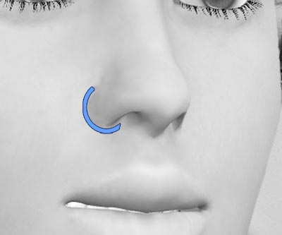 scars structure rhinoplasty - III